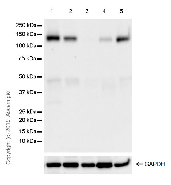 Western blot - Anti-Eph receptor B4/HTK antibody [EPR23221-54] (AB254300)