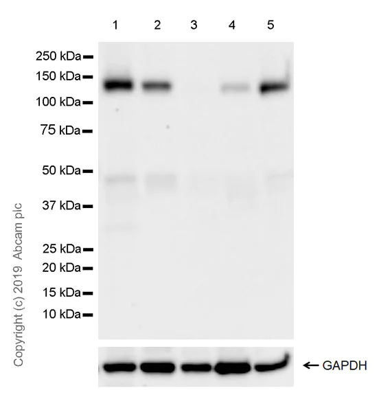 Western blot - Anti-Eph receptor B4/HTK antibody [EPR23221-54] (AB254300)