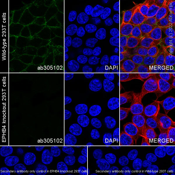 Immunocytochemistry/ Immunofluorescence - Anti-Eph receptor B4/HTK antibody [EPR23222-2] - BSA and Azide free (AB305071)