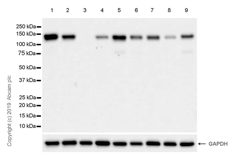 Western blot - Anti-Eph receptor B4/HTK antibody [EPR23222-24] (AB254301)