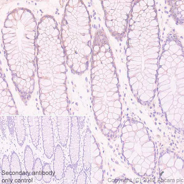 Immunohistochemistry (Formalin/PFA-fixed paraffin-embedded sections) - Anti-Eph receptor B4/HTK antibody [EPR23222-24] - BSA and Azide free (AB269369)