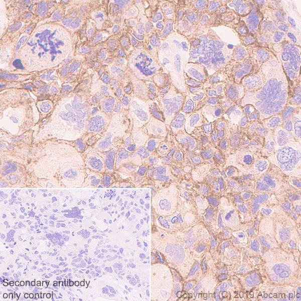 Immunohistochemistry (Formalin/PFA-fixed paraffin-embedded sections) - Anti-Eph receptor B4/HTK antibody [EPR23222-24] - BSA and Azide free (AB269369)