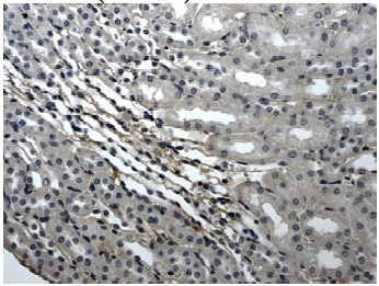 Immunohistochemistry (Formalin/PFA-fixed paraffin-embedded sections) - Anti-Eph receptor B4/HTK antibody [RM0056-6A14] (AB73259)