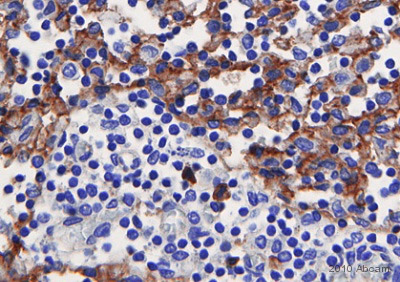 Immunohistochemistry (Formalin/PFA-fixed paraffin-embedded sections) - Anti-Eph receptor B4/HTK antibody [RM0056-6A14] (AB73259)