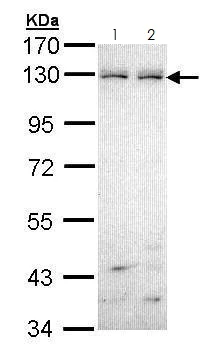 Western blot - Anti-Eph receptor B6 antibody (AB272882)