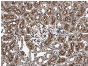 Immunohistochemistry (Formalin/PFA-fixed paraffin-embedded sections) - Anti-Eph receptor B6 antibody [RM0057-9B17] (AB73260)