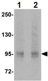 Western blot - Anti-EPHA10 antibody (AB106437)