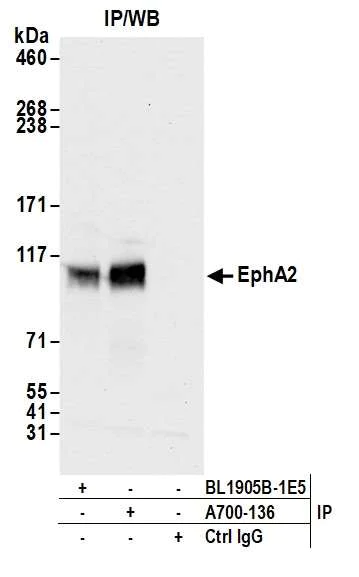 Immunoprecipitation - Anti-EphA2 antibody [BLR136H] - BSA free (AB314085)
