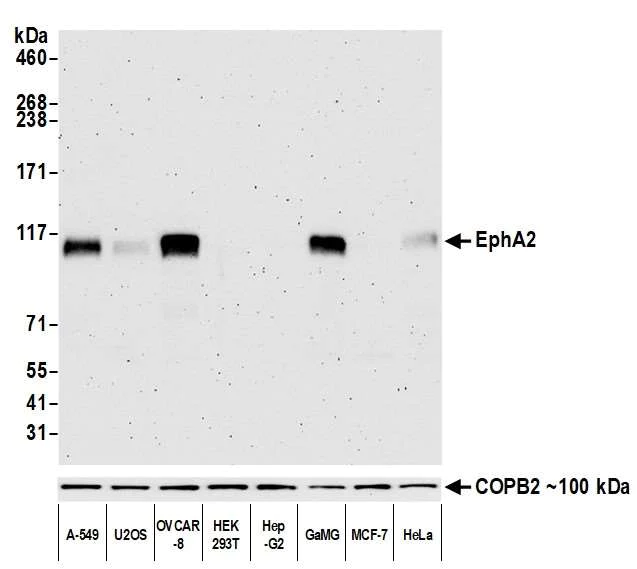 Western blot - Anti-EphA2 antibody [BLR136H] - BSA free (AB314085)