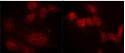 Immunocytochemistry/ Immunofluorescence - Anti-Ephexin-1 antibody - C-terminal (AB157593)