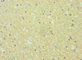 Immunohistochemistry (Formalin/PFA-fixed paraffin-embedded sections) - Anti-Ephrin A1 antibody (AB238505), expandable thumbnail