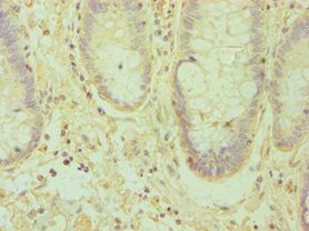 Immunohistochemistry (Formalin/PFA-fixed paraffin-embedded sections) - Anti-Ephrin A1 antibody (AB238505), expandable thumbnail
