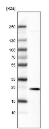 Western blot - Anti-Ephrin A1 antibody [CL6501] (AB243022), expandable thumbnail