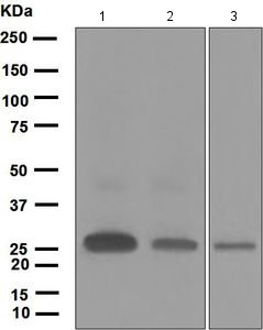 Western blot - Anti-Ephrin A1 antibody [EPR1785(2)] (AB124911), expandable thumbnail