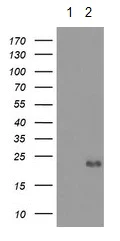 Western blot - Anti-Ephrin A2 antibody [OTI3E3] (AB123877)