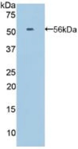 Western blot - Anti-Ephrin A4 antibody (AB232711)
