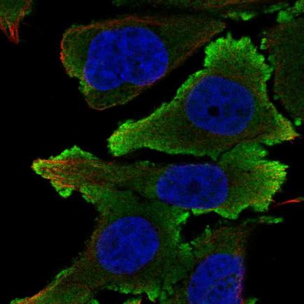 Immunocytochemistry/ Immunofluorescence - Anti-Ephrin B1 antibody (AB221652), expandable thumbnail