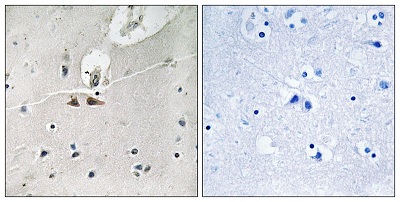 Immunohistochemistry (Formalin/PFA-fixed paraffin-embedded sections) - Anti-Ephrin B2 (phospho Y311) + Ephrin B3 (phospho Y318) + Ephrin B1 (phospho Y324) antibody (AB193634)
