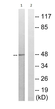 Western blot - Anti-Ephrin B2 (phospho Y311) + Ephrin B3 (phospho Y318) + Ephrin B1 (phospho Y324) antibody (AB193634)