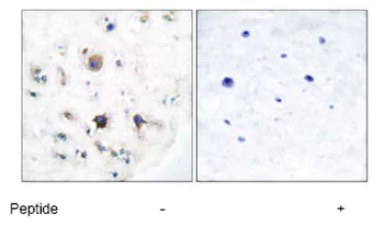 Immunohistochemistry (Formalin/PFA-fixed paraffin-embedded sections) - Anti-Ephrin B3 antibody (AB53063)