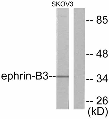 Western blot - Anti-Ephrin B3 antibody (AB53063), expandable thumbnail
