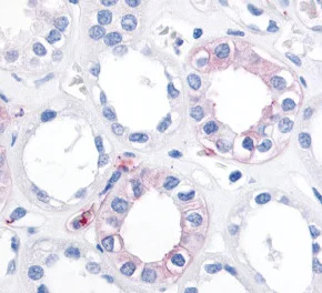Immunohistochemistry (Formalin/PFA-fixed paraffin-embedded sections) - Anti-EPHX2 antibody (AB115284)