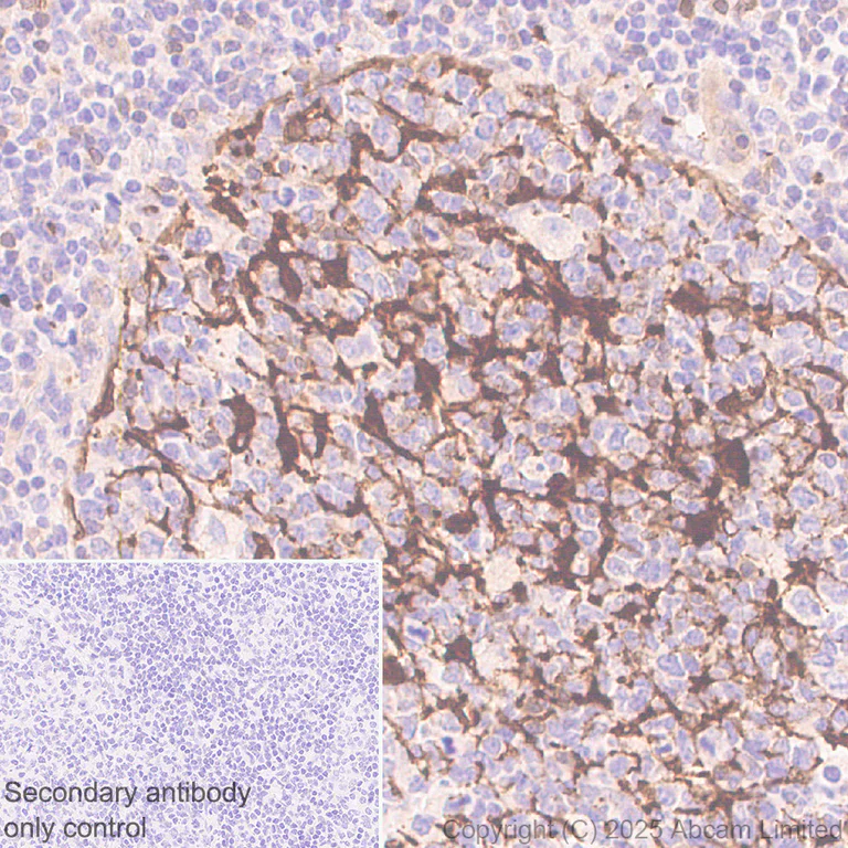 Immunohistochemistry (Formalin/PFA-fixed paraffin-embedded sections) - Anti-EPHX2 antibody [EPR30166-533] (AB324588)