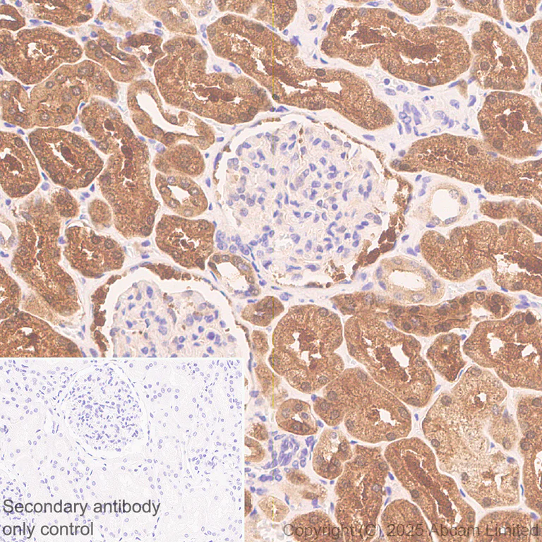 Immunohistochemistry (Formalin/PFA-fixed paraffin-embedded sections) - Anti-EPHX2 antibody [EPR30166-533] (AB324588)