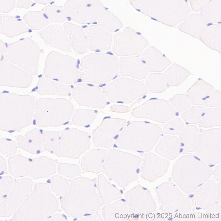 Immunohistochemistry (Formalin/PFA-fixed paraffin-embedded sections) - Anti-EPHX2 antibody [EPR30166-533] (AB324588)
