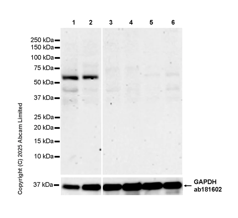 Western blot - Anti-EPHX2 antibody [EPR30166-533] (AB324588)