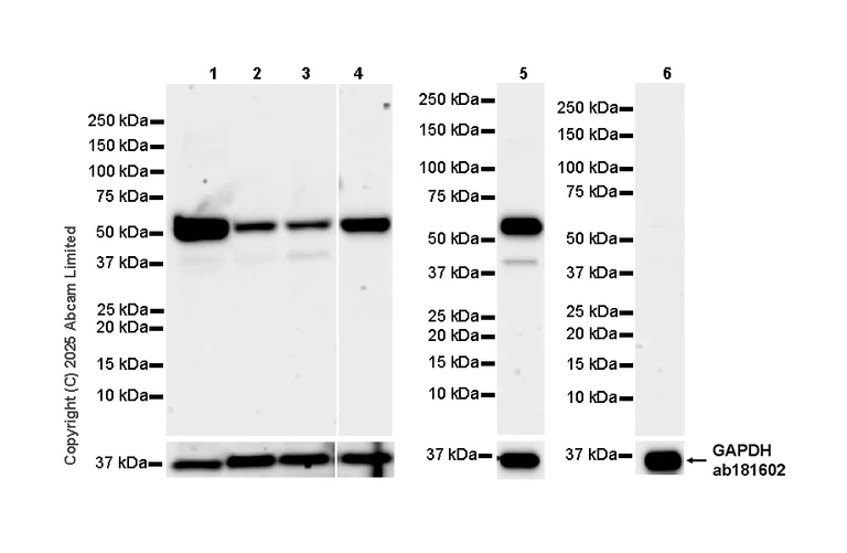 Western blot - Anti-EPHX2 antibody [EPR30166-533] (AB324588)