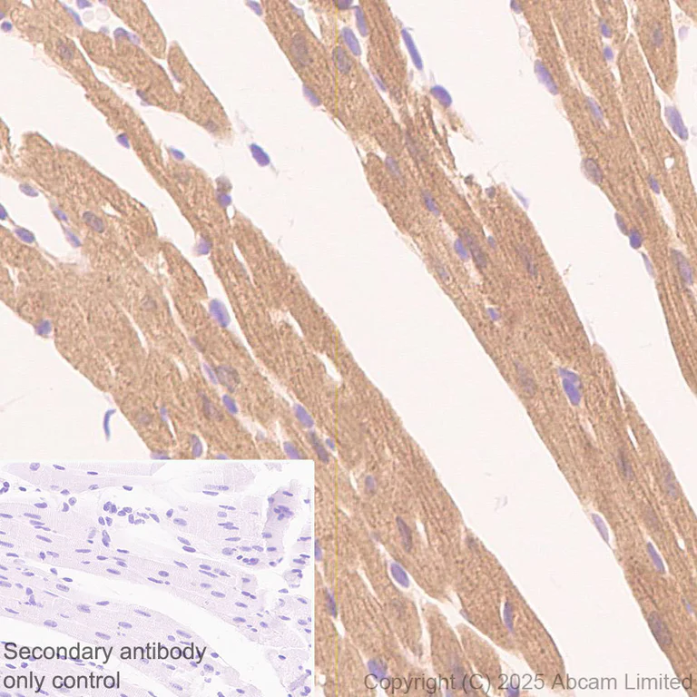 Immunohistochemistry (Formalin/PFA-fixed paraffin-embedded sections) - Anti-EPHX2 antibody [EPR30167-30] (AB324868)