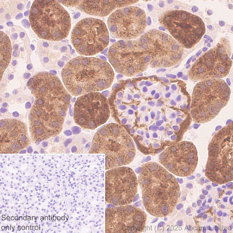 Immunohistochemistry (Formalin/PFA-fixed paraffin-embedded sections) - Anti-EPHX2 antibody [EPR30167-30] (AB324868)
