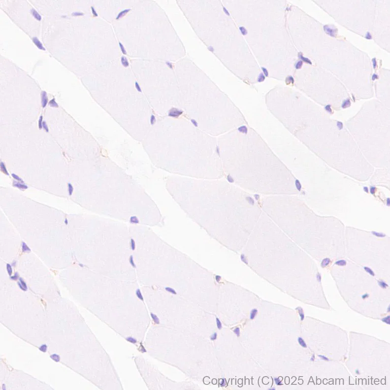 Immunohistochemistry (Formalin/PFA-fixed paraffin-embedded sections) - Anti-EPHX2 antibody [EPR30167-30] (AB324868)