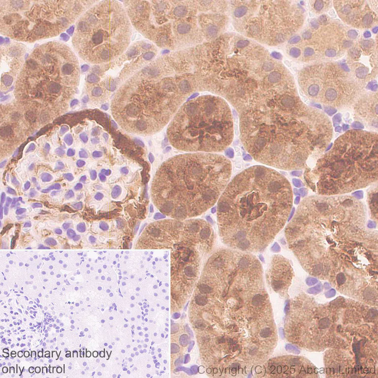 Immunohistochemistry (Formalin/PFA-fixed paraffin-embedded sections) - Anti-EPHX2 antibody [EPR30167-30] (AB324868)
