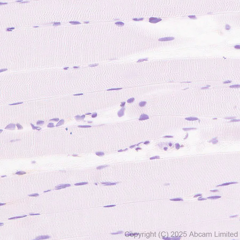 Immunohistochemistry (Formalin/PFA-fixed paraffin-embedded sections) - Anti-EPHX2 antibody [EPR30167-30] (AB324868)