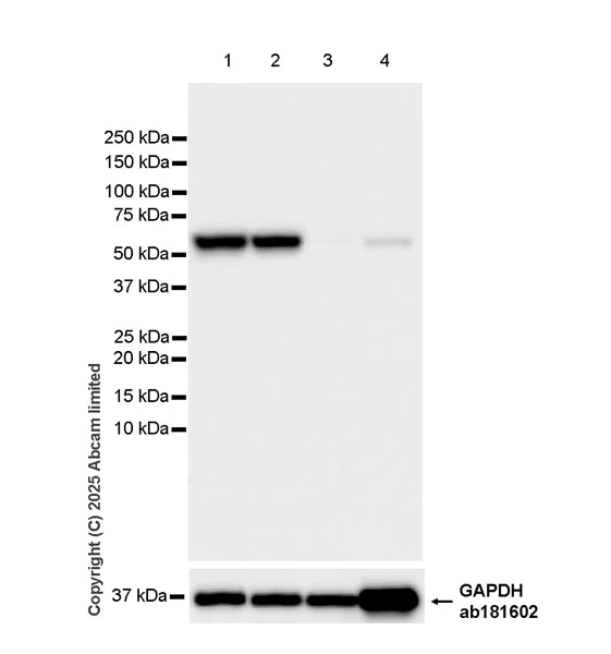 Western blot - Anti-EPHX2 antibody [EPR30167-30] (AB324868)