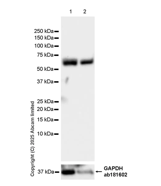 Western blot - Anti-EPHX2 antibody [EPR30167-30] (AB324868)
