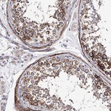 Immunohistochemistry (Formalin/PFA-fixed paraffin-embedded sections) - Anti-Epiphycan antibody (AB122449)