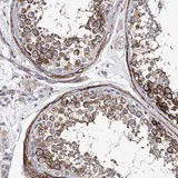 Immunohistochemistry (Formalin/PFA-fixed paraffin-embedded sections) - Anti-Epiphycan antibody (AB122449)