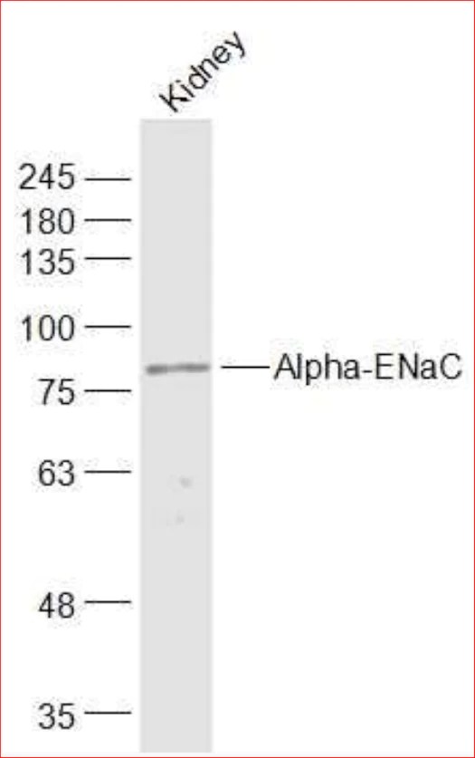 Western blot - Anti-epithelial Sodium Channel alpha antibody (AB214192)