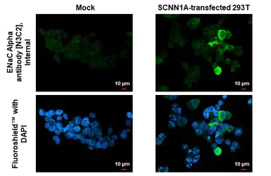 Immunocytochemistry/ Immunofluorescence - Anti-epithelial Sodium Channel alpha antibody (AB272878)