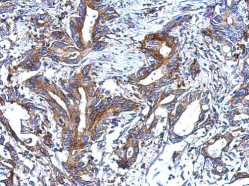 Immunohistochemistry (Formalin/PFA-fixed paraffin-embedded sections) - Anti-epithelial Sodium Channel alpha antibody (AB272878), expandable thumbnail