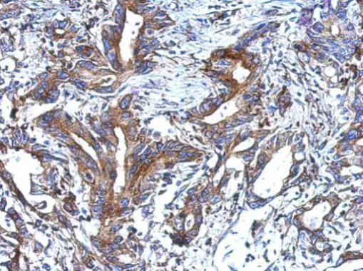 Immunohistochemistry (Formalin/PFA-fixed paraffin-embedded sections) - Anti-epithelial Sodium Channel alpha antibody (AB272878)