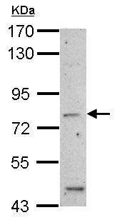 Western blot - Anti-epithelial Sodium Channel alpha antibody (AB272878), expandable thumbnail