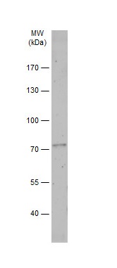 Western blot - Anti-epithelial Sodium Channel alpha antibody (AB272878), expandable thumbnail