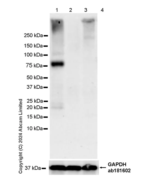 Western blot - Anti-epithelial Sodium Channel alpha antibody [EPR28997-46] (AB322260)