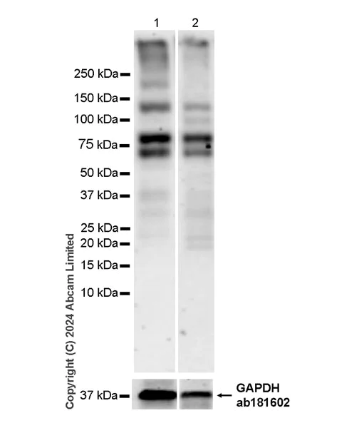 Western blot - Anti-epithelial Sodium Channel alpha antibody [EPR28997-46] (AB322260)