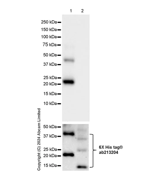 Western blot - Anti-epithelial Sodium Channel alpha antibody [EPR28997-46] - BSA and Azide free (AB324794)