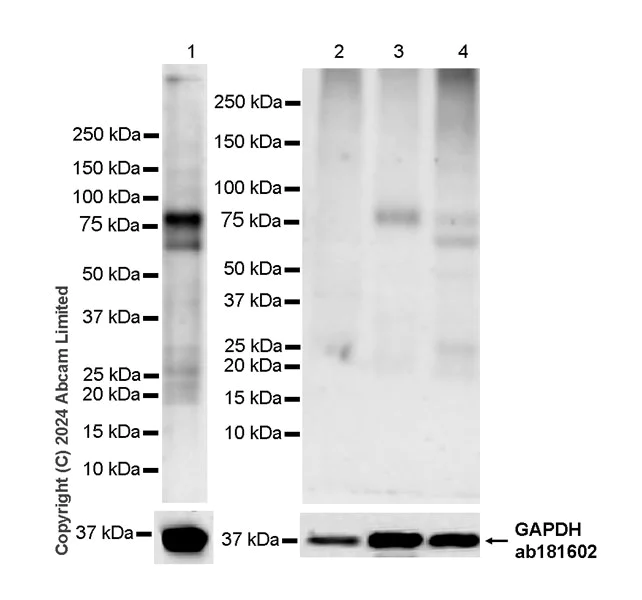 Western blot - Anti-epithelial Sodium Channel alpha antibody [EPR28997-46] - BSA and Azide free (AB324794)